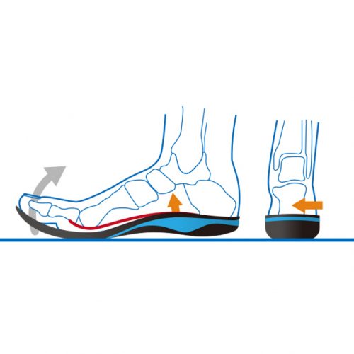 基於絞盤吊起作用的理想線條