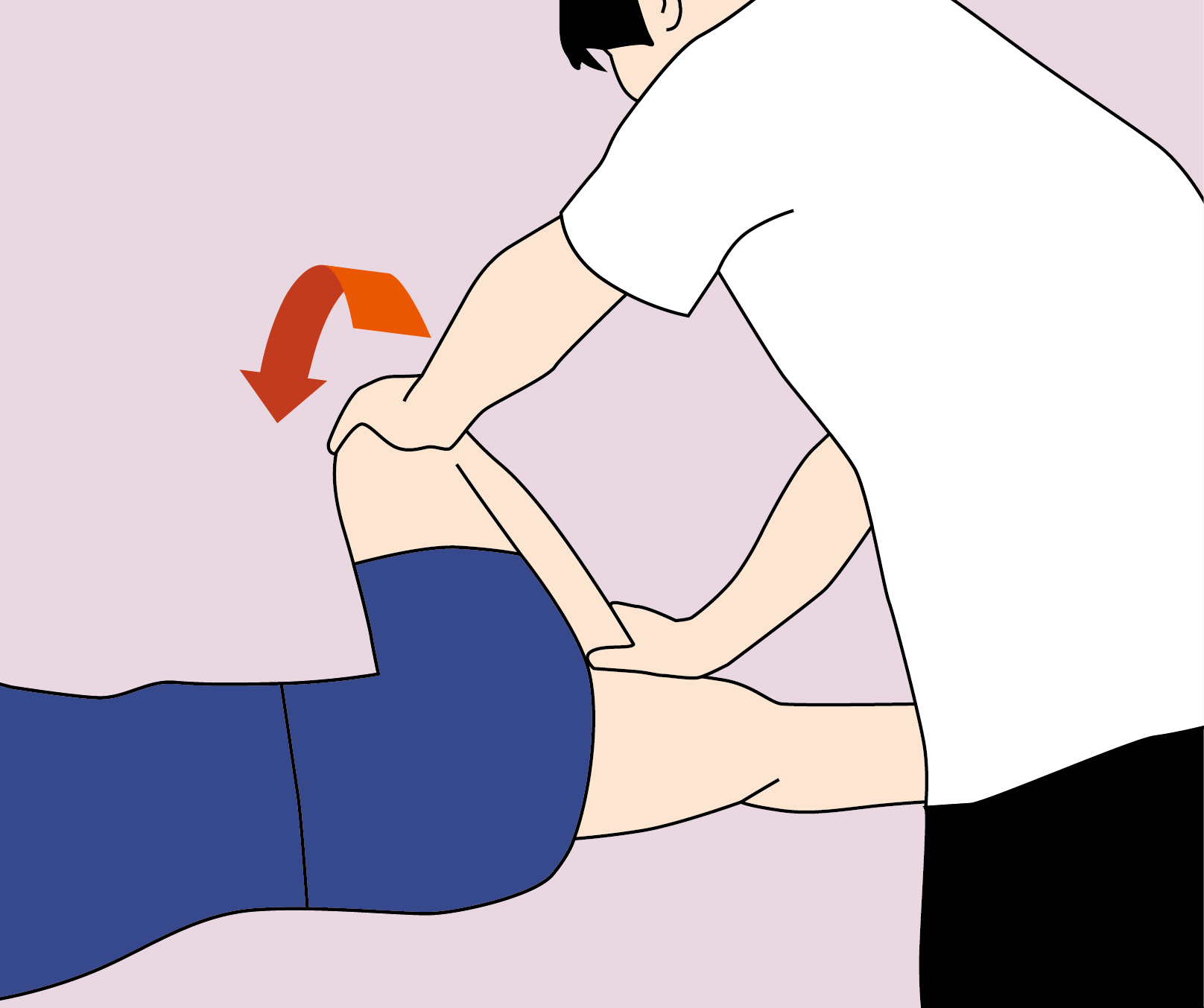 Piriformis Syndrome 2